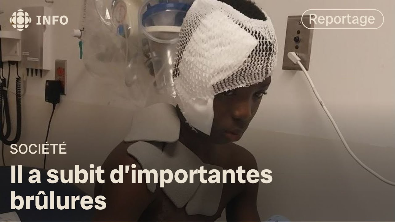 Un enfant ébouillanté par une femme à Longueuil