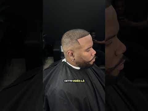 MON CLIENT DEVIENT CHAUVE